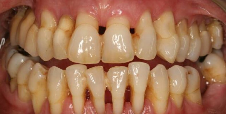 Здоровые зубы – красивая улыбка