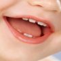 Лечение зубов у детей. Профилактика кариеса