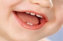 Лечение зубов у детей. Профилактика кариеса